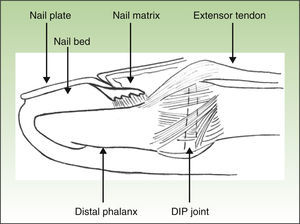 Anatomical relationship between the nail and distal interphalangeal extensor tendor enthesis.