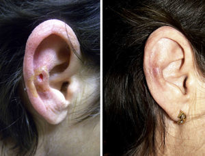 Clinical image of patient 20 before and after treatment.