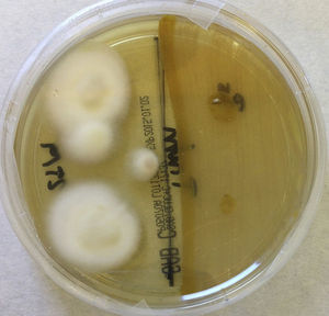 Sabouraud dextrose agar with chloramphenicol inoculated with Trichophyton rubrum with and without previous seeding with Pseudomonas aeruginosa. Incubation for 12 days at 28°C.