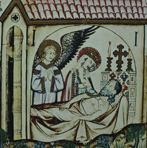 The man described in Cantiga 93 suffered from a disease that caused skin lesions. Note how they are depicted as generalized plaques or crusts that might correspond to psoriasis or eczema. The Virgin uncovers her breast and sprays her milk onto the patient's skin. © by Patrimonio Nacional.