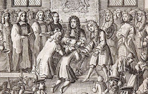Illustration of Charles II of England extending the royal touch. This king is estimated to have performed the ceremony with some 92000 patients with scrofula over the course of his reign. Engraving by Robert White (1864). The image, in the public domain, is available from https://en.wikipedia.org/wiki/royal_touch.