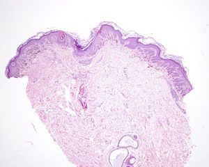 Hematoxylin and eosin, original magnification×40.