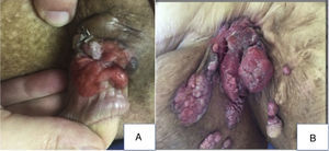 A, Tumor in the groin. B, Tumor on the shaft of the penis.