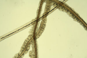 Mucoid sheaths around the hairs. Potassium hydroxide, original magnificationx40.