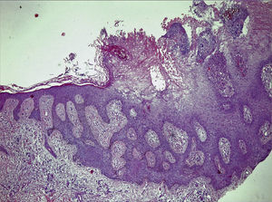 Hematoxylin-eosin, original magnification ×10.