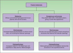 Diagnostic algorithm for facial melanosis.