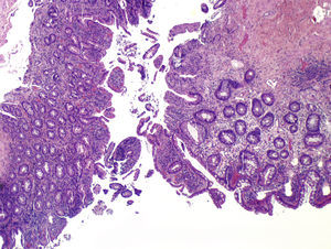 Hematoxylin-eosin, original magnification ×20.