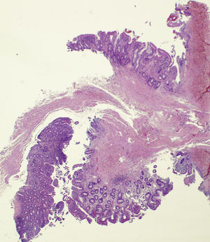 Hematoxylin-eosin, original magnification ×100.