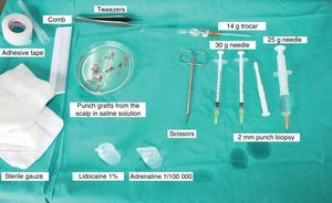 Material used for extraction and implantation of the punch grafts.