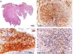A, Hematoxylin-eosin, original magnification x1. B, C, and D, Hematoxylin-eosin, original magnification x20.
