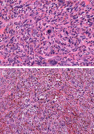 A, Hematoxylin-eosin, original magnification ×40. B, Hematoxylin-eosin, original magnification ×20.