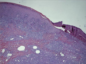 Hematoxylin-eosin, original magnification ×10.