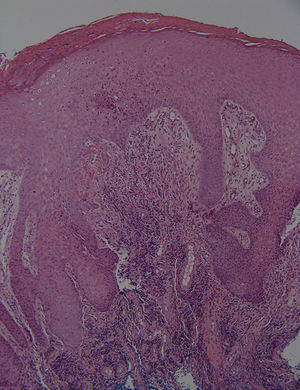 Hematoxylin•eosin í100.