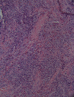 Hematoxylin•eosin í200.