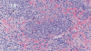 Hematoxylin-eosin, original magnification ×40.