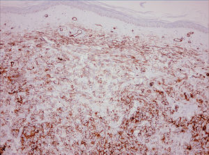 CD34 immunohistochemical staining (original magnification ×10).