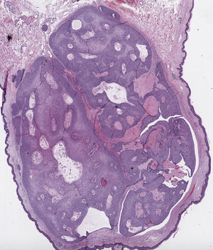 Panoramic view (hematoxylin-eosin).