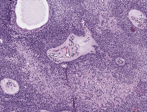 Hematoxylin-eosin, original magnification ×10.