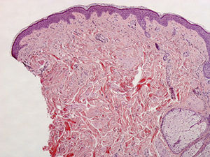 Hematoxylin-eosin, original magnification×40.