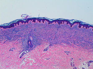 Hematoxylin-eosin, original magnification x40.