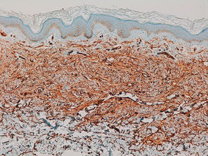 CD34-stained sections, original magnification×100.