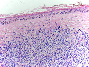 Hematoxylin-eosin, original magnification ×40.