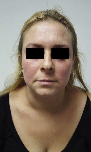 Response to therapy after 5 months of treatment.