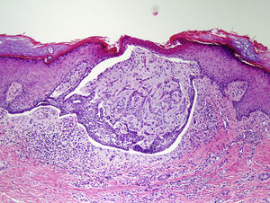 Hematoxylin-eosin, ×10.