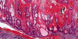 Hematoxylin-eosin, original magnification ×2.
