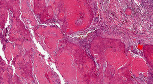 Hematoxylin-eosin, original magnification ×4.