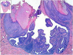 Hematoxylin-eosin staining in both histology images.