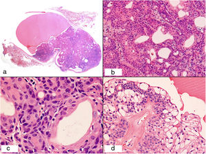 Hematoxylin-eosin: a) ×1; b) ×10; c) ×40; d) ×20.