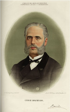 Disseminated canities. Plate IV in the section on spontaneous local skin diseases or deformities.