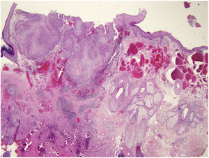 Hematoxylin-eosin, original magnification × 10.