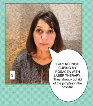 Communication in cosmetic dermatology: Clinical case 3. This case presents several challenges: the patient is asking for a cure for a chronic disease and, what is more, it appears that this is what she has understood from what she was told when receiving treatment in a hospital. We must clarify the real situation, patiently explaining what rosacea is and what laser therapy can achieve and further add that any treatment will require maintenance. In effect, we have to bring her expectations into line with reality.