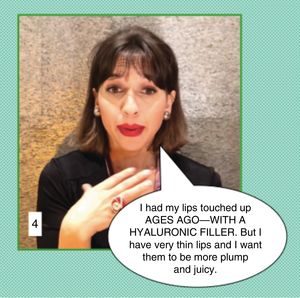 Communication in cosmetic dermatology: Clinical case 4. In this case, the physician may be surprised for a number of reasons. The patient is talking about a defect we do not perceive. It is possible that the patient has body dysmorphic disorder. Furthermore, she may be lying when she says that the previous lip augmentation procedure with hyaluronic filler was done “ages ago”. Looking at her lips, we can see that the procedure was more likely performed recently or perhaps it was not done with hyaluronic filler but rather with some other material that would contraindicate hyaluronic therapy. The patient also complains about the results of earlier treatment. In this situation, without hurting her feelings, the best course of action would be to tell the patient that you are unable to offer her that treatment because, medically, you do not consider it to be indicated at this time. In this exchange it is unnecessary to either contradict or agree with the patient.