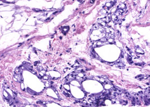 Hematoxylin–eosin, ×200.