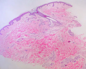 Hematoxylin-eosin, original magnification, ×25.