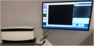 VivaScope 2500 4th Gen® (MAVIG GmbH, Munich, Germany).