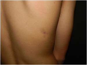Clinical appearance of the lesion.