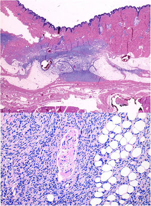 Upper panel: original magnification ×4. Lower panel: original magnification ×200.
