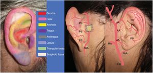 Schematic of the ear anatomy and the main anatomical areas. Arterial vascularization of the auricle of concha: posterior auricular artery (PAA) and its perforating branches (PB). External carotid (EC), maxillary artery (MA), anterior auricular arteries (AA), superficial temporal artery (STA).