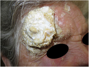Appearance of patient's forehead on entering the consulting room.