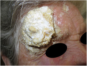 Appearance of patient