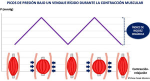 Pressure peaks under a stiff bandage during muscle contraction.
