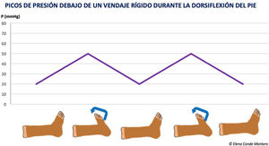 Pressure peaks under a stiff bandage during dorsiflexion of the foot.