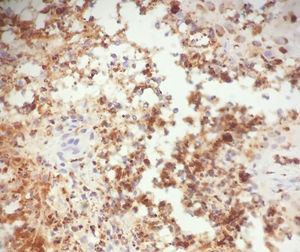 Immune staining with myeloperoxidase (hematoxylin–eosin, ×400).