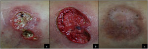 Clinical course.
