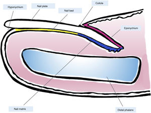 Macroscopic anatomy of the normal nail: the nail apparatus is covered in its most proximal part by the proximal nail fold. The epithelium of the ventral face of this fold is denoted eponychium (in pink) and produces the true cuticle (in black), which is firmly adhered to the nail plate. The nail matrix (in blue), divided into the proximal and distal matrix, produces the plate and continues distally into the bed. Both the matrix and the bed are covered by the nail plate. Finally, the bed (in yellow) ends distally in the hyponychium.
