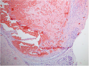 Hematoxylin-eosin, ×100.